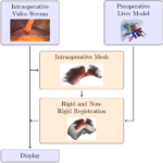 ROS-based Image Guidance Navigation System for Minimally Invasive Liver Surgery